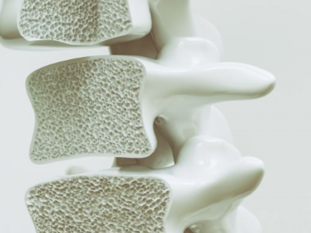 Θέλεις οστά υγιή και μετά τα 50; Είναι στο χέρι σου να το πετύχεις