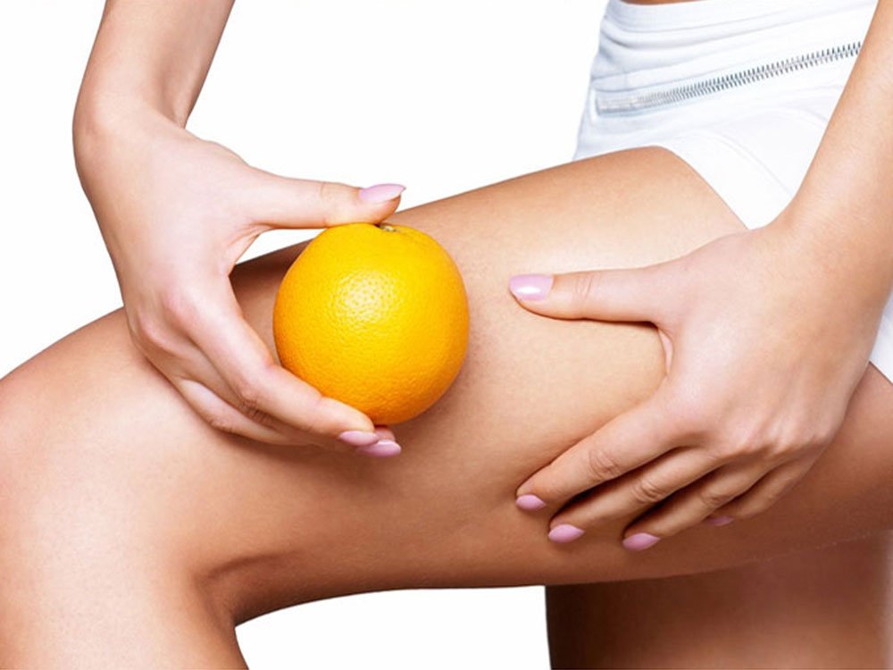 Για να νικήσεις την κυτταρίτιδα, ξεφορτώσου άμεσα αυτούς τους 12 μύθους